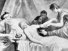 Thawed Medieval Surgeon Still Prescribing Too Much Bloodletting Despite All the Evidence