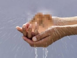 Patient Literally Sweats His Balls Off