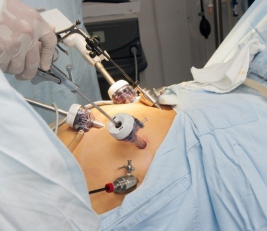 Flatulence to Blame for Failed Laparoscopic Procedure Laparoscopic surgery
