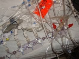 It Took Over 3 Years, But ICU Team Finally Finishes Untangling All Those Lines