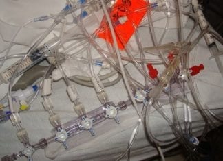 ICU Team Excited to Untangle Lines After Patient Dropped Off from OR
