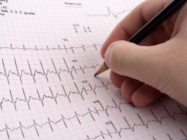 Cardiologist Admits to Just Using EKG Computer Interpretation for Over 15 Years EKG