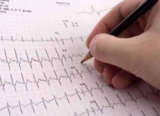 Cardiologist Admits to Just Using EKG Computer Interpretation for Over 15 Years EKG
