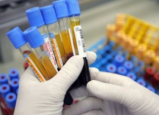 Local Woman: ‘I Need All My Labs Drawn’ lab tests