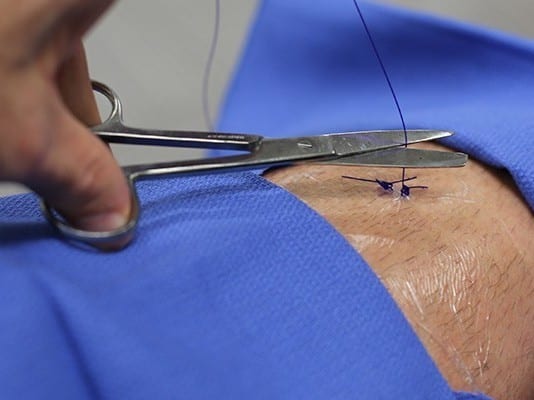 Breaking: Medical Student Cuts Surgical Knot Too Short