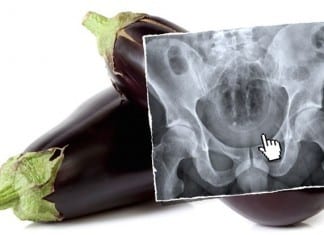 Genuine ‘Slipped and Fell’ Rectal Foreign Body Victim Stuns Experts