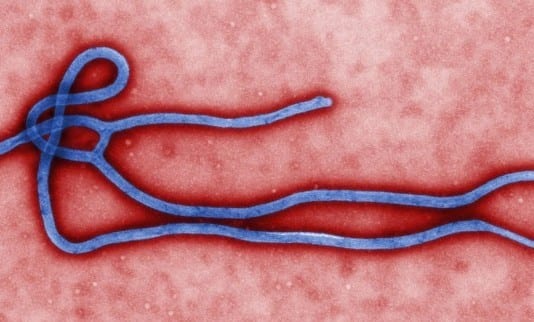Texas Ebola Doctor: ‘Nurse, I’ll Be Right Behind You’