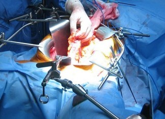 Mass General to Offer New Residency in Retractor Holding