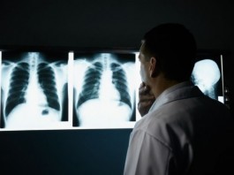 Radiology Intern Already Unable to Completely Exclude Any Diagnosis radiologist