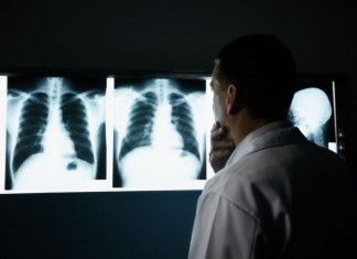 Radiology Intern Already Unable to Completely Exclude Any Diagnosis radiologist