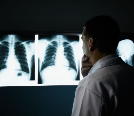 Radiology Intern Already Unable to Completely Exclude Any Diagnosis radiologist