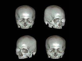 3D Head CT: The New Ultimate Selfie head ct