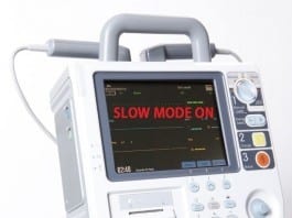 ICU Team Develops Defibrillator With New Setting: The Slow Code Mode defibrillator