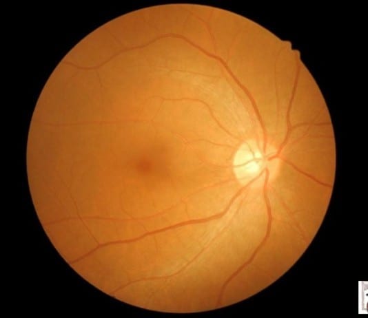 NASA: New Planet Discovered with Equatorial Volcano and Rivers of Lava new planet