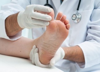 Rivalry Between Family Practitioner and Podiatrist Linked Back to One Case of Foot Fungus athlete's foot