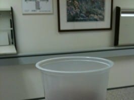 Hospital Staff Deciding If Cup at Nurses Station is Filled With Urine-Colored Tea or Tea-Colored Urine urine sample