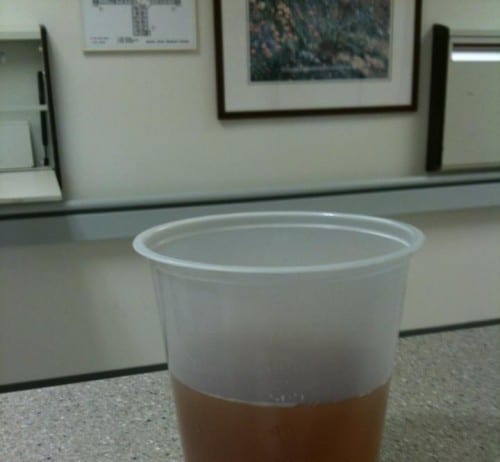 Hospital Staff Deciding If Cup at Nurses Station is Filled With Urine-Colored Tea or Tea-Colored Urine urine sample