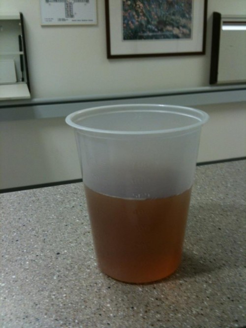 Hospital Staff Deciding If Cup at Nurses Station is Filled With Urine