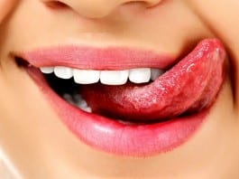 Medical Student Discovers First Taste-Based Physical Exam Finding, Diagnosis Psoriasis licking