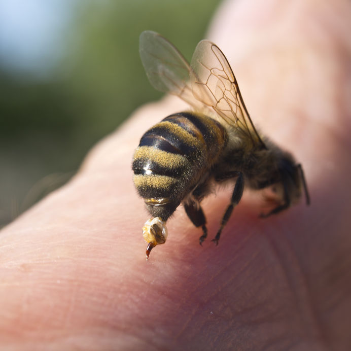 infected bee sting