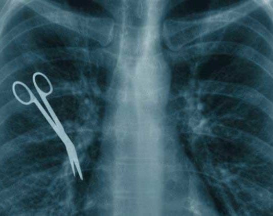 New Year’s Resolution: Hospital Moving Away from Term “Never Event”… Due to Frequency of Events never event medical error