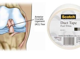 Orthopedic Surgeon Arrested for Using Duct Tape to Repair ACLs acl knee