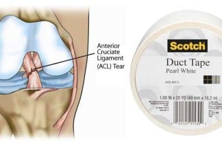 Orthopedic Surgeon Arrested for Using Duct Tape to Repair ACLs acl knee