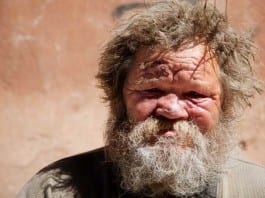 Industrious Homeless Man Creates Hospital Room-Share Website