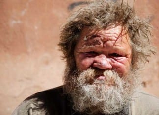 Industrious Homeless Man Creates Hospital Room-Share Website