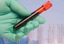 Skilled Phlebotomist Draws Blood from Aorta aorta