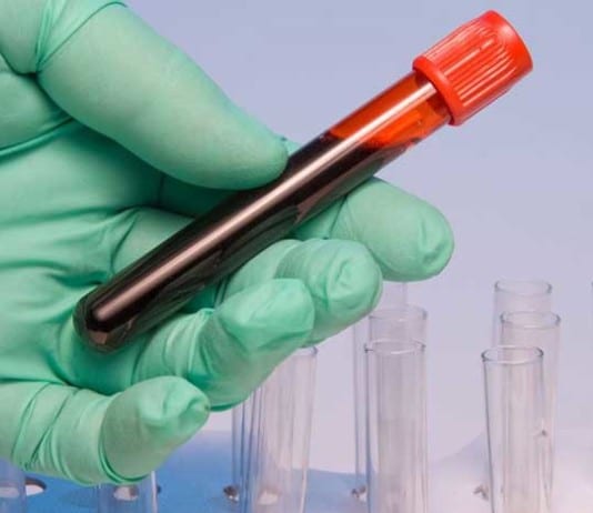 Skilled Phlebotomist Draws Blood from Aorta aorta