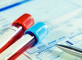 CBC To Be Replaced By Cheaper Incomplete Blood Count cbc