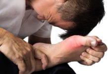 Area Emergency Physician Successfully Manages Gout Without Consultation gout