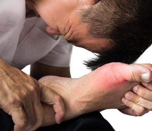 Area Emergency Physician Successfully Manages Gout Without Consultation gout