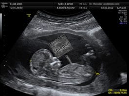 Fetuses Leave Mothers’ Wombs in Pregxit Vote