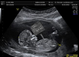 Fetuses Leave Mothers’ Wombs in Pregxit Vote