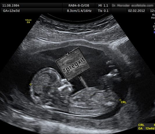 Fetuses Leave Mothers’ Wombs in Pregxit Vote