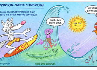 Medcomic: WPW Edition (Whoa, Surf’s Up!)