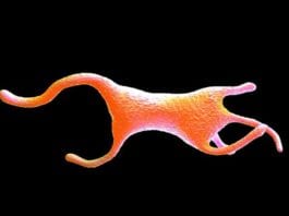 Single-Celled Organism Caught Masquerading as VA ICU Nurse amoeba
