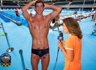 Michael Phelps Has a Few Too Many Cupping Marks Near Genitals