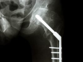 Ortho Consults Medicine for Surgical Management surgical management