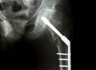 Ortho Consults Medicine for Surgical Management surgical management