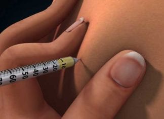 New Narcan Reversal Agent, NarCANT, Hits the Market injection