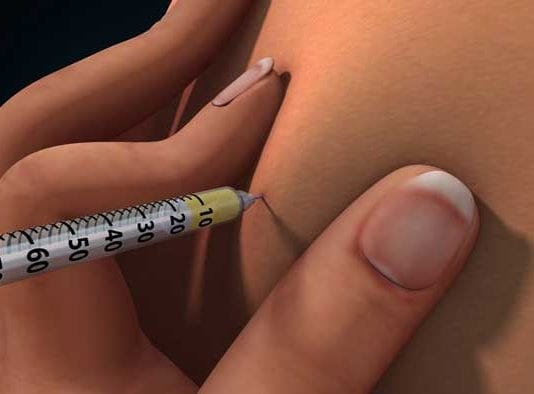 New Narcan Reversal Agent, NarCANT, Hits the Market injection