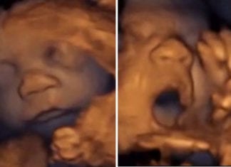 Beyoncé’s 3-Month Sonogram Reveals Twins Harmonizing In Womb sonogram