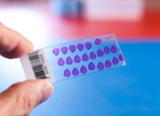 Pathology Slide Fills Out Poor Satisfaction Survey About Pathologist pathology slide