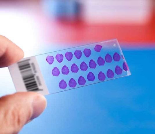 Pathology Slide Fills Out Poor Satisfaction Survey About Pathologist pathology slide