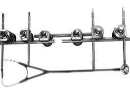 Ortho Stabilizes Stethoscope with External Fixator external fixator