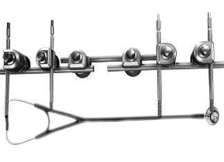 Ortho Stabilizes Stethoscope with External Fixator external fixator