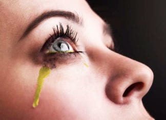 After Being Given 200 mg of IV Lasix, Patient Urinating from Eyeballs urine urinating eyeballs